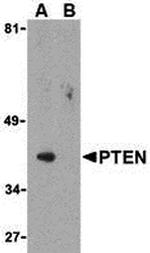 PTEN Antibody in Western Blot (WB)