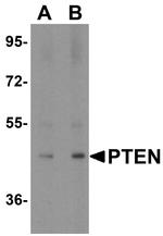 PTEN Antibody in Western Blot (WB)