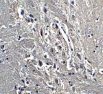 Kinesin 5A Antibody in Immunohistochemistry (IHC)