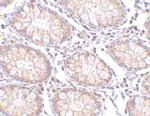 PTK7 Antibody in Immunohistochemistry (IHC)