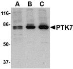 PTK7 Antibody in Western Blot (WB)