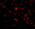 ARMET Antibody in Immunocytochemistry (ICC/IF)