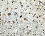 ARMET Antibody in Immunohistochemistry (Paraffin) (IHC (P))