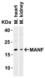 ARMET Antibody in Western Blot (WB)