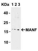 ARMET Antibody in Western Blot (WB)