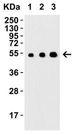 ARMET Antibody in Western Blot (WB)