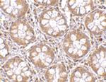 RASD2 Antibody in Immunohistochemistry (IHC)