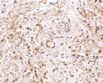 TEM5 Antibody in Immunohistochemistry (IHC)