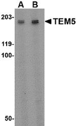 TEM5 Antibody in Western Blot (WB)