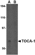 TOCA-1 Antibody in Western Blot (WB)