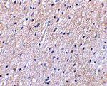 Nhe-1 Antibody in Immunohistochemistry (IHC)