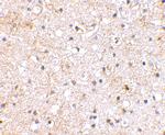 GRIK1 Antibody in Immunohistochemistry (IHC)