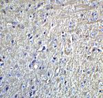 GRIK1 Antibody in Immunohistochemistry (IHC)