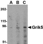 GRIK5 Antibody in Western Blot (WB)