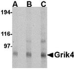 GRIK4 Antibody in Western Blot (WB)