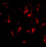 ATG12 Antibody in Immunocytochemistry (ICC/IF)