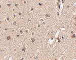 ATG12 Antibody in Immunohistochemistry (IHC)