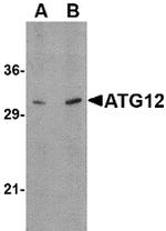 ATG12 Antibody in Western Blot (WB)