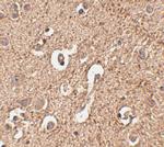 ATG12 Antibody in Immunohistochemistry (IHC)