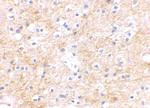 SAPAP3 Antibody in Immunohistochemistry (IHC)