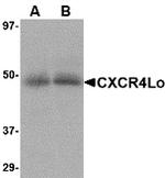 CXCR4 Antibody in Western Blot (WB)