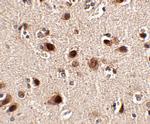 SLITRK5 Antibody in Immunohistochemistry (IHC)