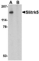 SLITRK5 Antibody in Western Blot (WB)