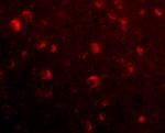 SLITRK6 Antibody in Immunocytochemistry (ICC/IF)