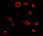 ATG16L1 Antibody in Immunocytochemistry (ICC/IF)