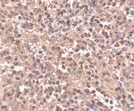 ATG5 Antibody in Immunohistochemistry (IHC)