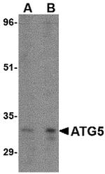 ATG5 Antibody in Western Blot (WB)