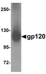 HIV1 gp120 Antibody in Western Blot (WB)