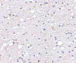 SIRT2 Antibody in Immunohistochemistry (IHC)