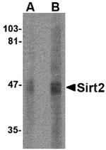 SIRT2 Antibody in Western Blot (WB)