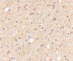 LGI2 Antibody in Immunohistochemistry (IHC)