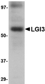 LGI3 Antibody in Western Blot (WB)