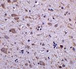 IRGM Antibody in Immunohistochemistry (IHC)