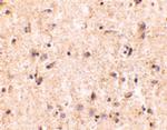 IRGM Antibody in Immunohistochemistry (IHC)