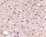 AMBRA1 Antibody in Immunohistochemistry (IHC)