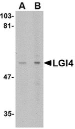 LGI4 Antibody in Western Blot (WB)