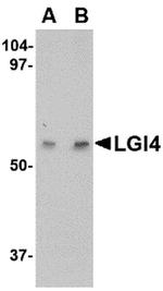 LGI4 Antibody in Western Blot (WB)