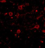 CAPS1 Antibody in Immunohistochemistry (IHC)