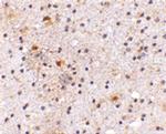 CAPS1 Antibody in Immunohistochemistry (IHC)