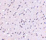 CADPS2 Antibody in Immunohistochemistry (IHC)