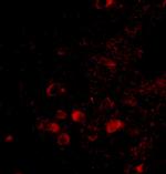 ELOVL6 Antibody in Immunohistochemistry (IHC)