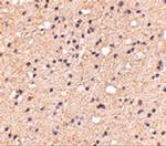 ELOVL6 Antibody in Immunohistochemistry (IHC)