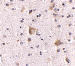 RIM2 Antibody in Immunohistochemistry (IHC)