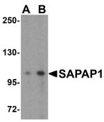 SAPAP1 Antibody in Western Blot (WB)
