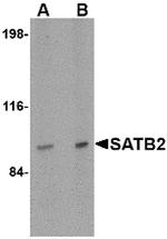 SATB2 Antibody in Western Blot (WB)