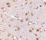 SATB1 Antibody in Immunohistochemistry (IHC)